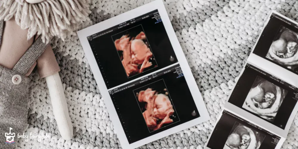 Affordable Ultrasound Services Near You: An In-Depth Look at Baby Fairytale