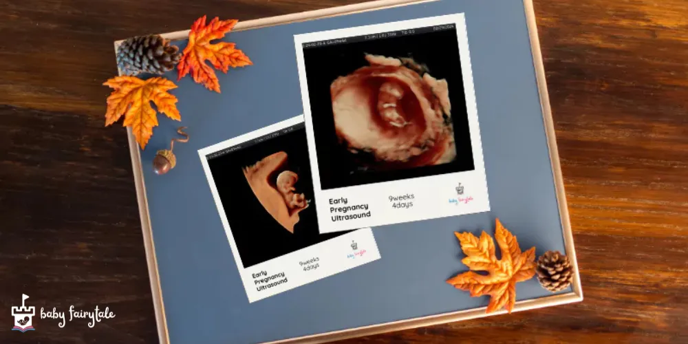 Your Baby’s First Thanksgiving: How Ultrasound Sessions Capture Holiday Memories