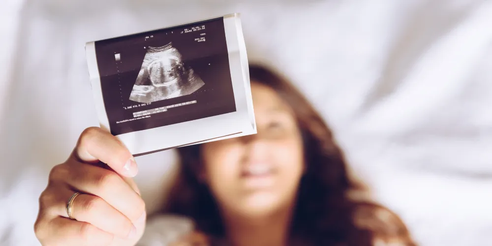What to Expect at Your 20-Week Anatomy Scan