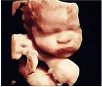 Baby inside the womb