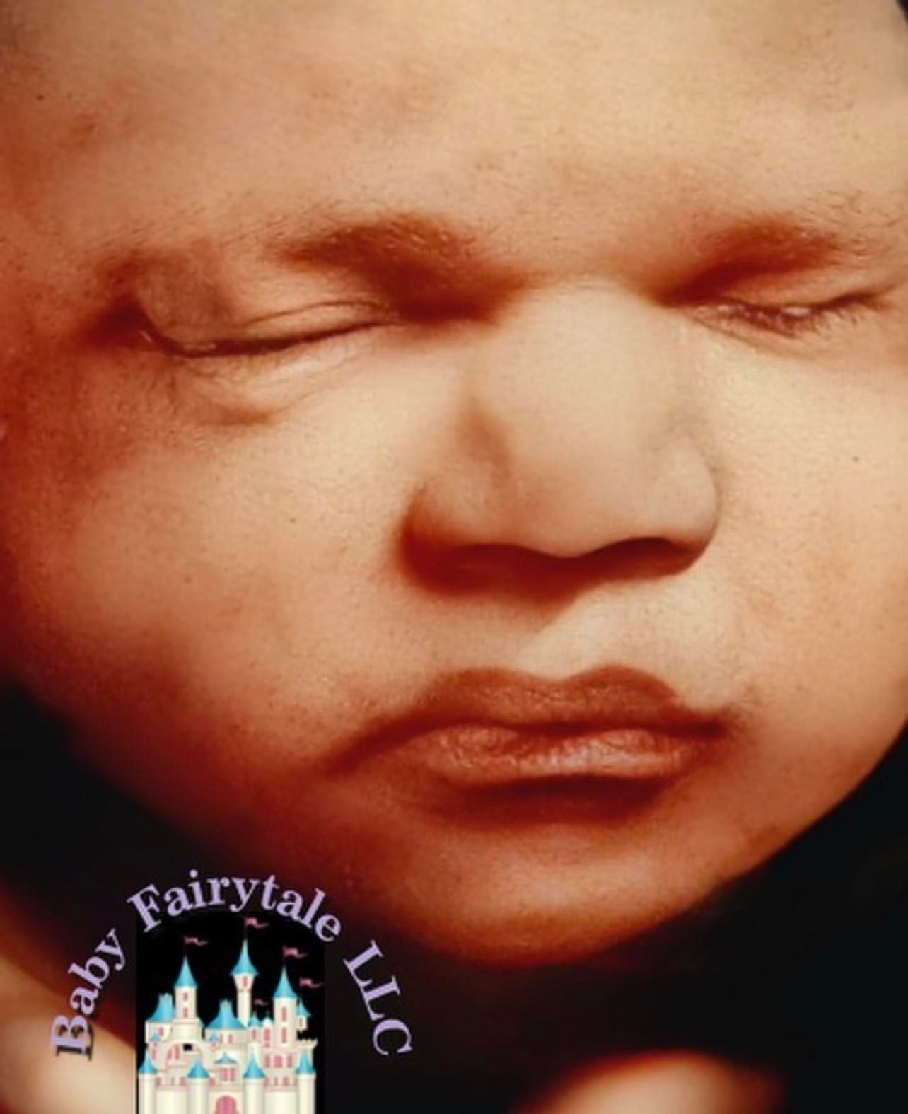 3D/4D and HDLive ultrasounds at Baby Fairytale