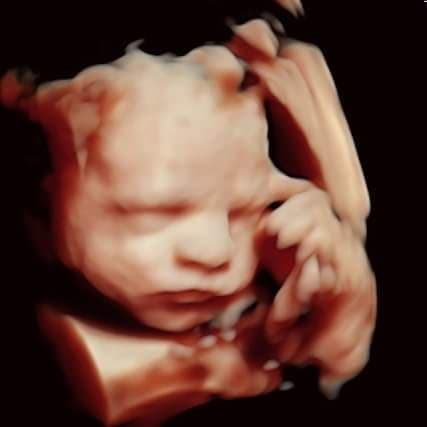 3D/4D and HDLive ultrasounds at Baby Fairytale