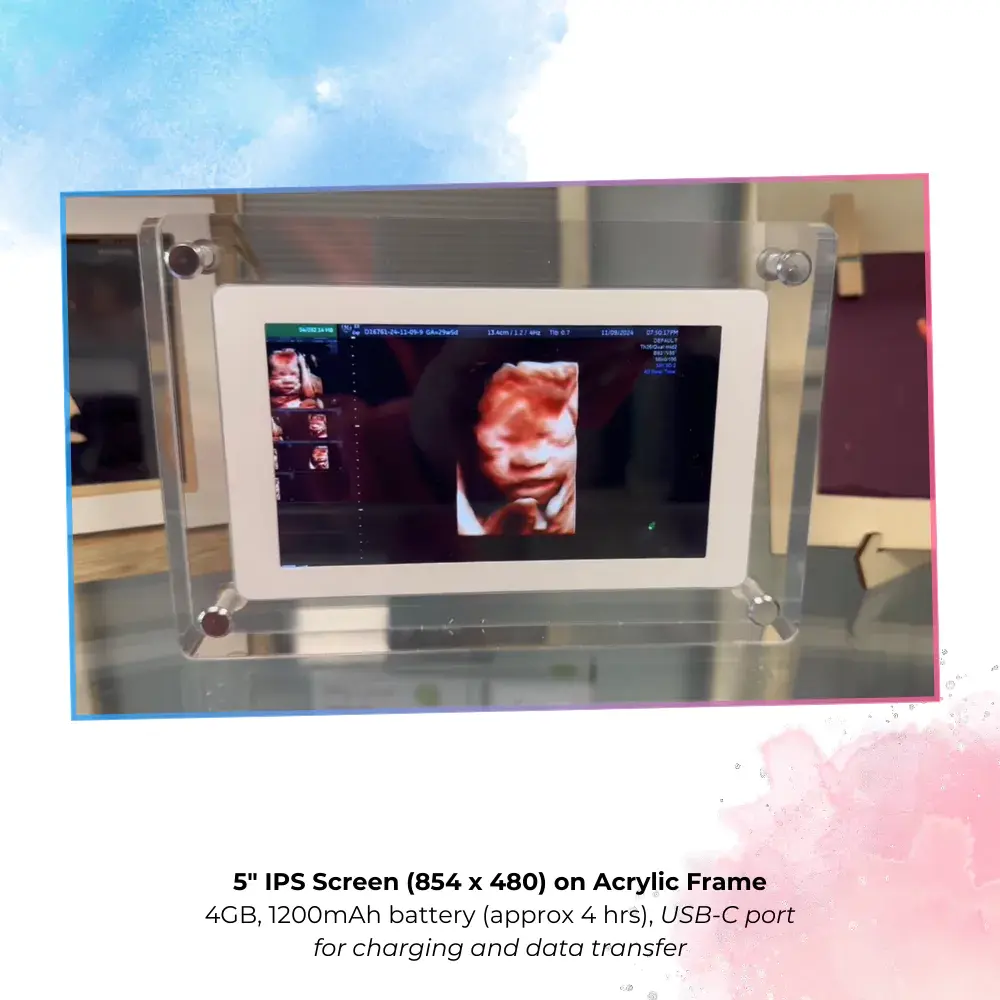 Ultrasound Video Frame