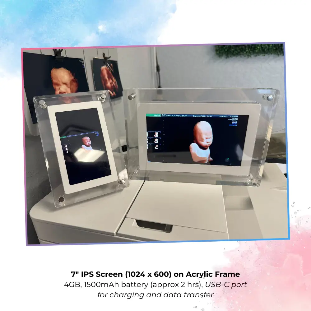 Ultrasound Video Frame